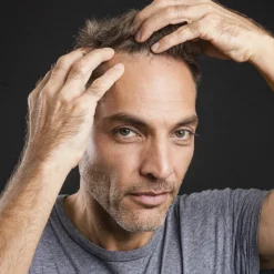 Hoitotuote rasvoittuville hiuksille